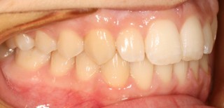 Intraorales Bild02 [320x200]